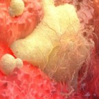 Global RAF Proto Oncogene Serine/Threonine Protein Kinase Market 2019 Basilea Pharmaceutica AG, Eli Lilly and Company