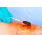 Global Wound Cleaning Agent Market 2019 3M Healthcare (US), B. Braun Medical (Germany), Hollister Wound Care (US)